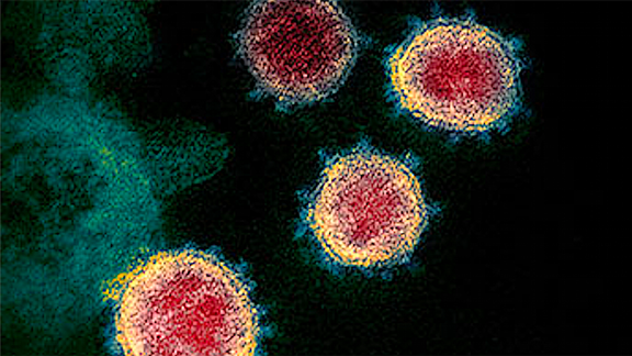 microscopic view of Corona virus strain